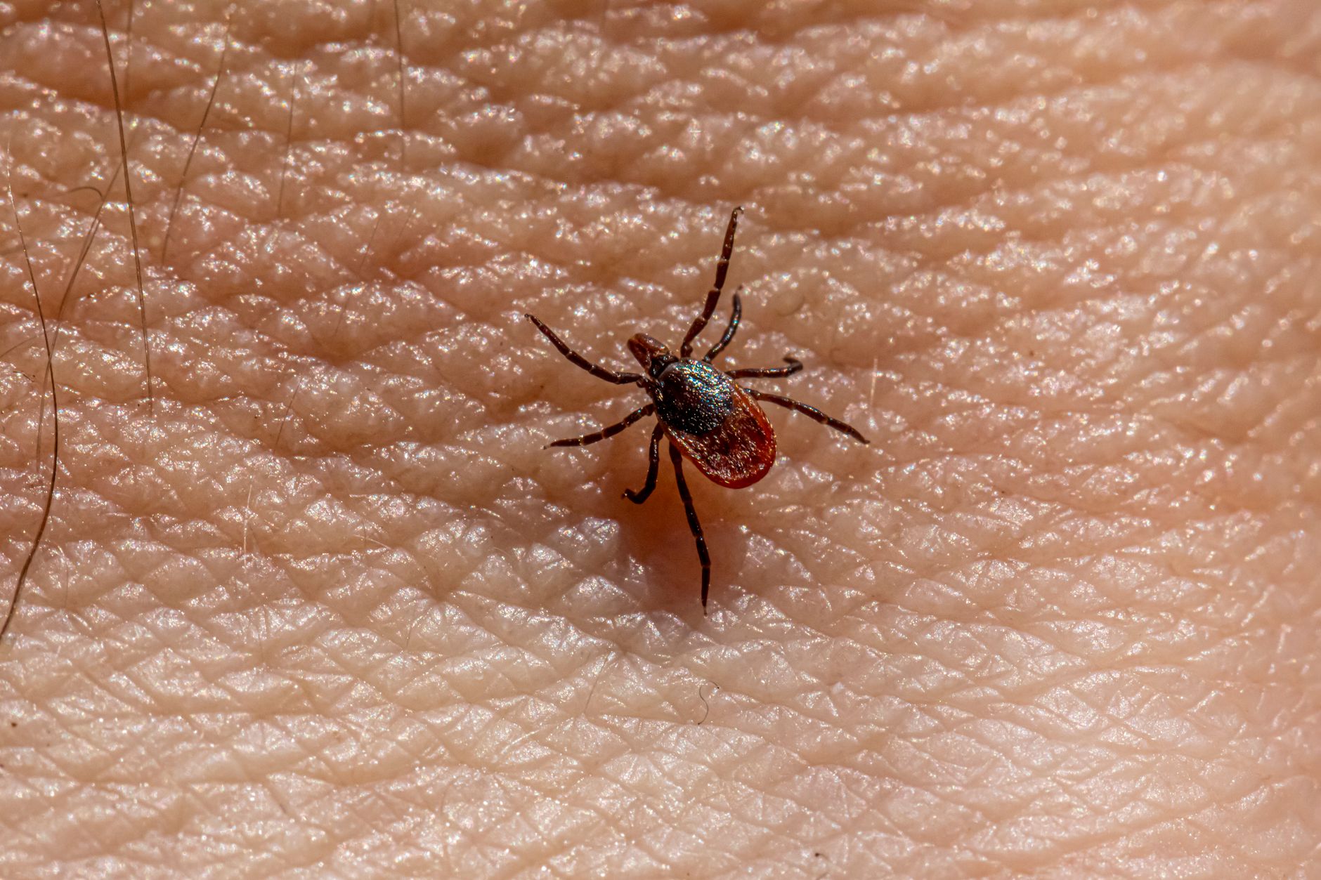 Detailed close-up of a tick on human skin showing its texture and tiny size.