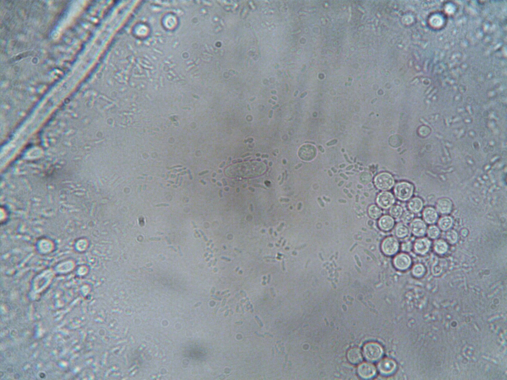 High-resolution microscope image showing various cellular structures and organisms.